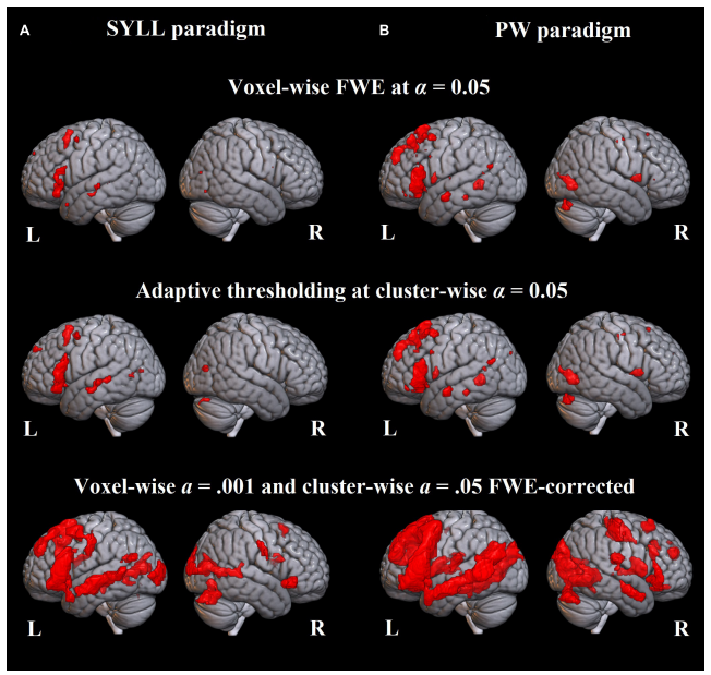 Новая статья Центра языка и мозга в журнале Frontiers in Human Neuroscience