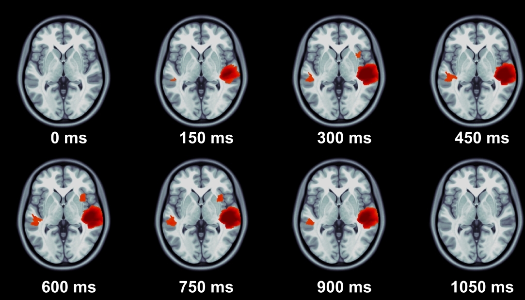 Новая статья Центра языка и мозга вышла в журнале Human Brain Mapping